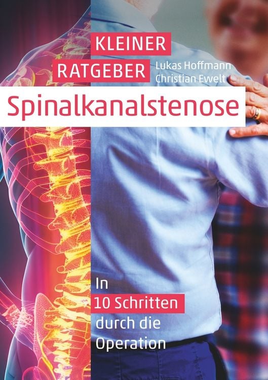 Produktbild: Kleiner Ratgeber Spinalkanalstenose