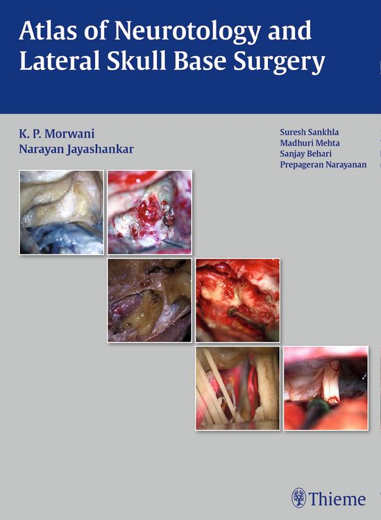 Produktbild: Atlas of Neurotology and Lateral Skull Base Surgery