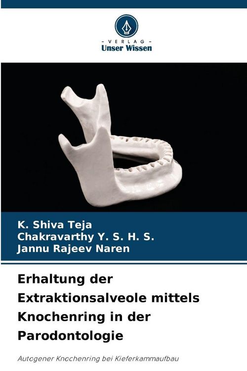 Produktbild: Erhaltung der Extraktionsalveole mittels Knochenring in der Parodontologie