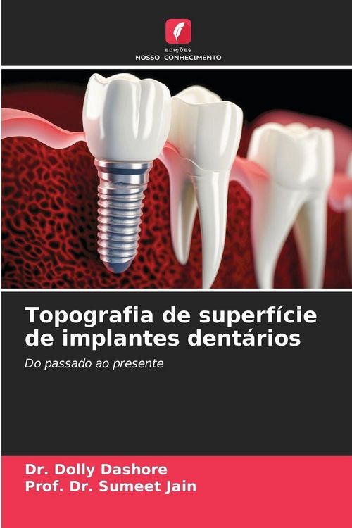 Produktbild: Topografia de superf&iacute;cie de implantes dent&aacute;rios