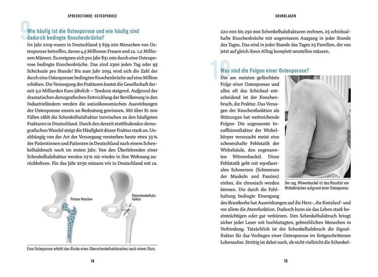 Produktbild: In der Sprechstunde: Osteoporose