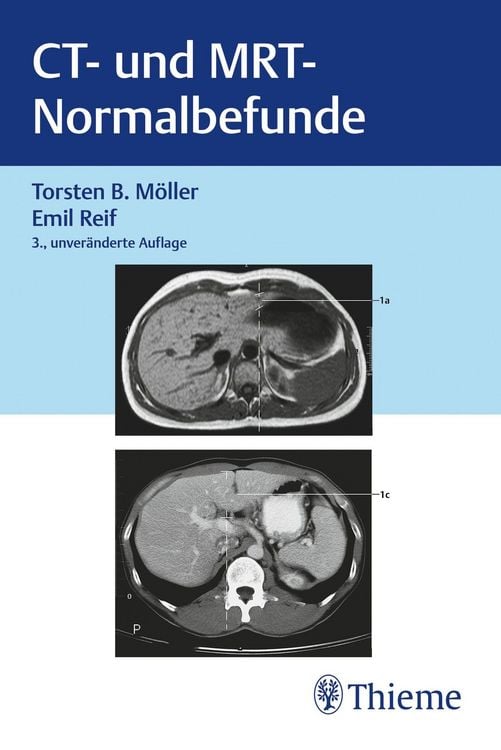 Produktbild: CT und MRT Normalbefunde