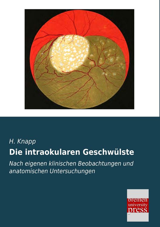 Produktbild: Die intraokularen Geschw&uuml;lste
