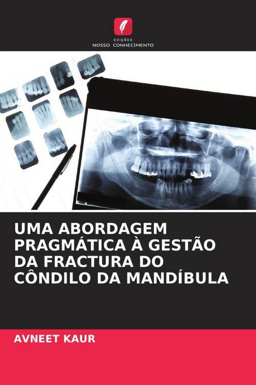 Produktbild: Uma Abordagem Pragm&aacute;tica &Agrave; Gest&atilde;o Da Fractura Do C&ocirc;ndilo Da Mand&iacute;bula