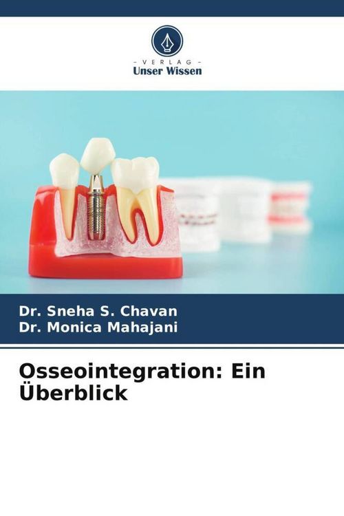 Produktbild: Osseointegration: Ein &Uuml;berblick
