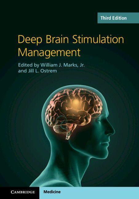 Produktbild: Deep Brain Stimulation Management
