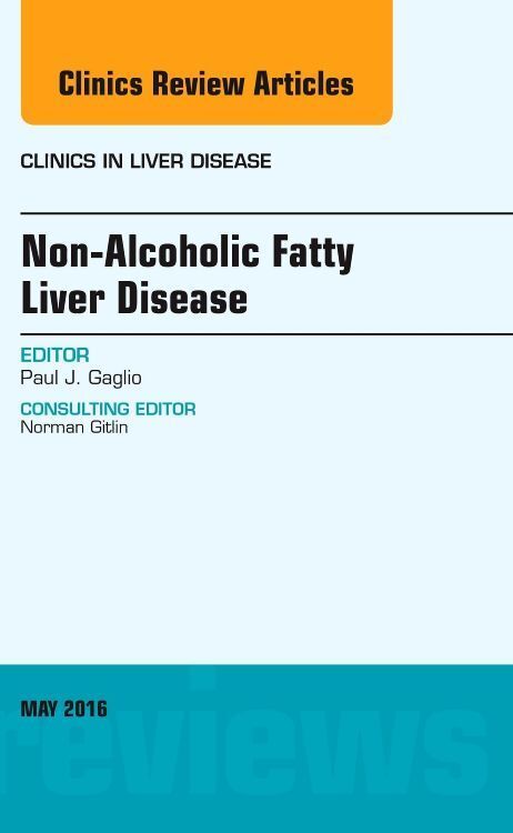 Produktbild: Non-Alcoholic Fatty Liver Disease, an Issue of Clinics in Liver Disease