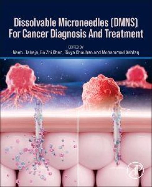 Produktbild: Dissolvable Microneedles (Dmns) for Cancer Diagnosis and Treatment