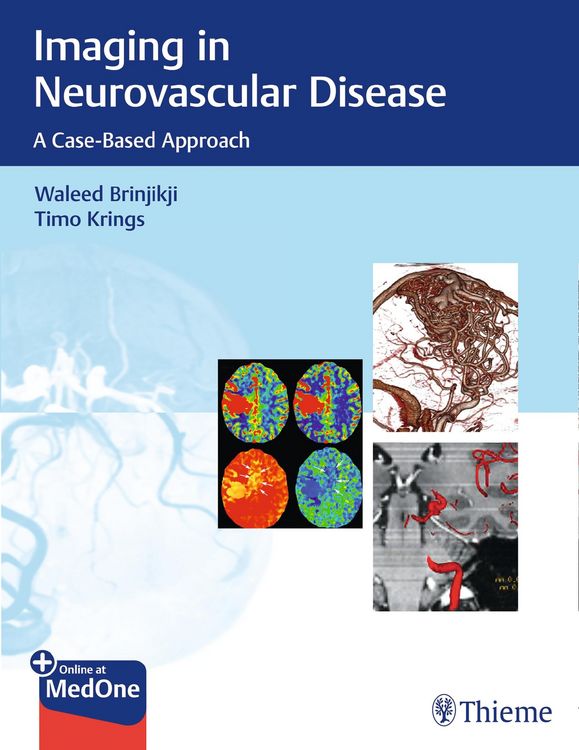 Produktbild: Imaging in Neurovascular Disease