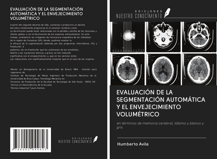 Produktbild: Evaluaci&oacute;n De La Segmentaci&oacute;n Autom&aacute;tica Y El Envejecimiento Volum&eacute;trico