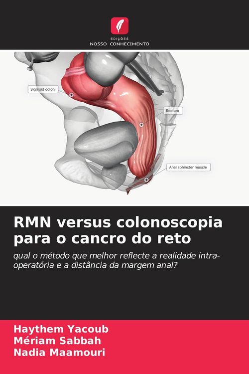 Produktbild: RMN versus colonoscopia para o cancro do reto