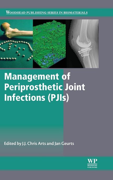 Produktbild: Management of Periprosthetic Joint Infections (Pjis)