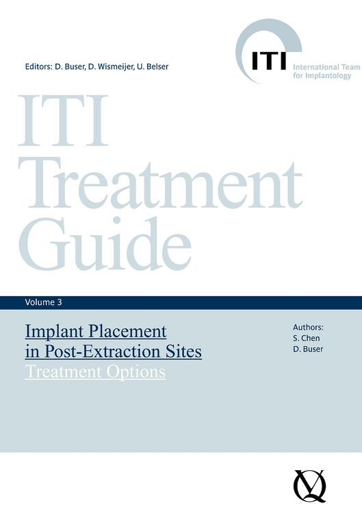 Produktbild: Implant Placement in Post-Extraction Sites