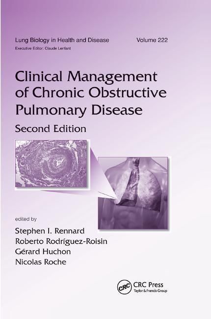 Produktbild: Clinical Management of Chronic Obstructive Pulmonary Disease
