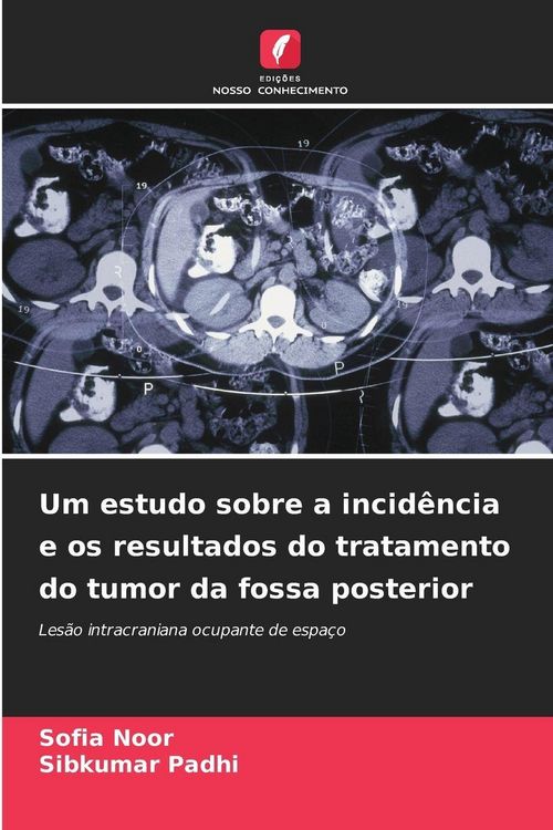 Produktbild: Um estudo sobre a incid&ecirc;ncia e os resultados do tratamento do tumor da fossa posterior
