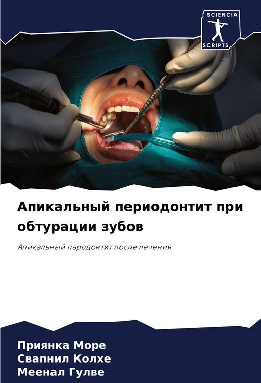 Produktbild: Apikal'nyj periodontit pri obturacii zubow