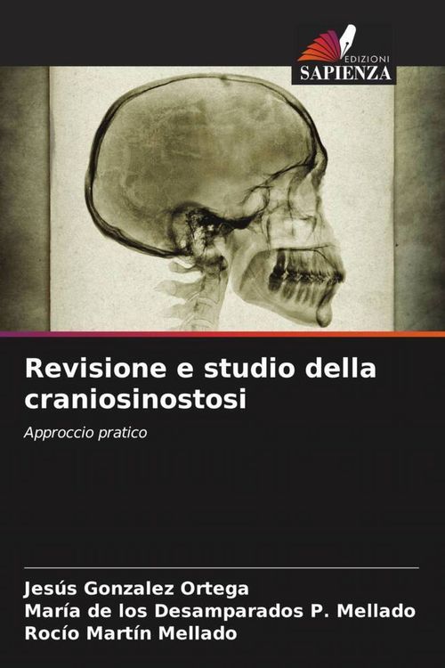 Produktbild: Revisione e studio della craniosinostosi