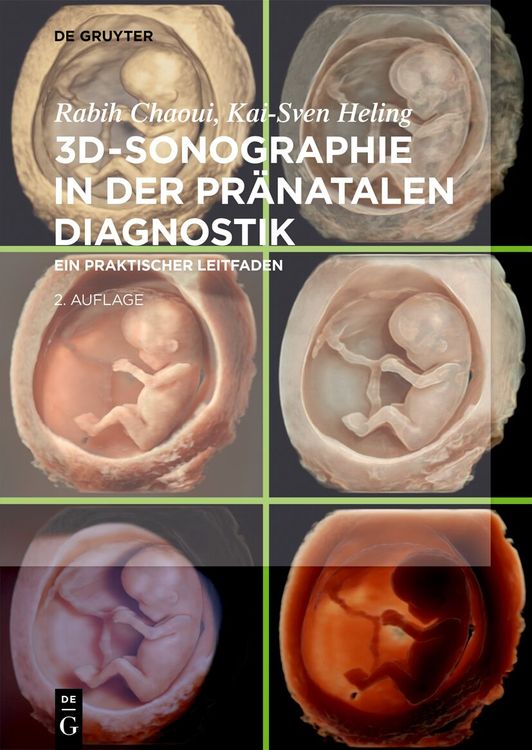 Produktbild: 3D-Sonographie in der pr&auml;natalen Diagnostik