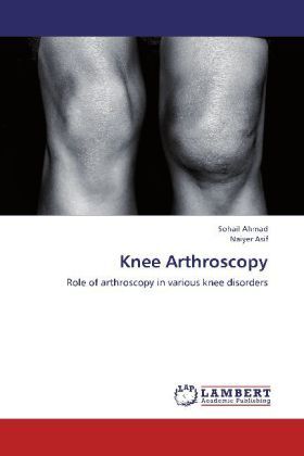 Produktbild: Ahmad, S: Knee Arthroscopy