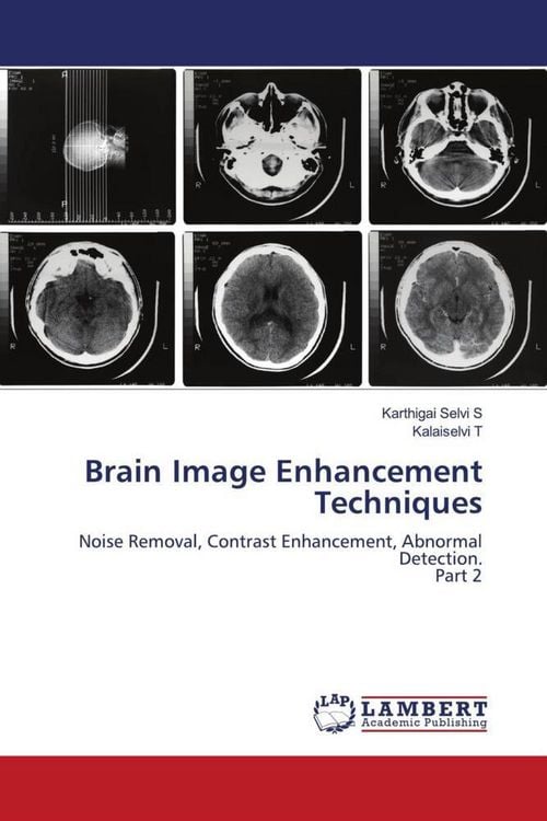 Produktbild: Brain Image Enhancement Techniques