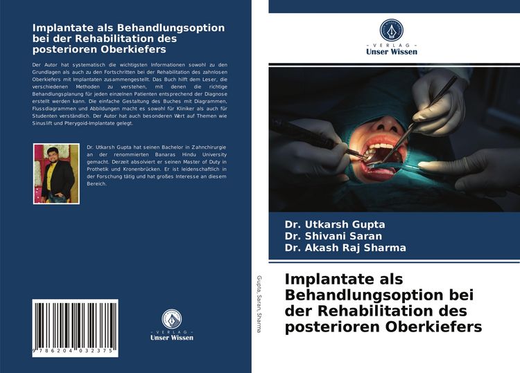 Produktbild: Implantate als Behandlungsoption bei der Rehabilitation des posterioren Oberkiefers