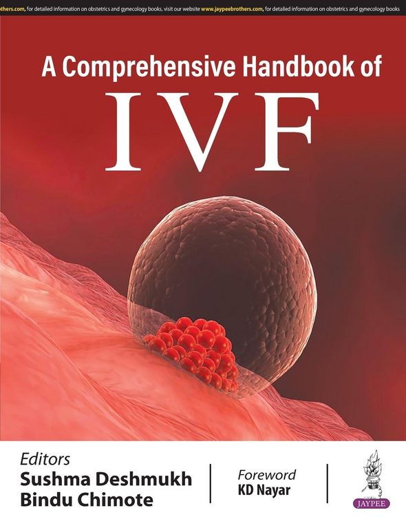 Produktbild: A Comprehensive Handbook of IVF