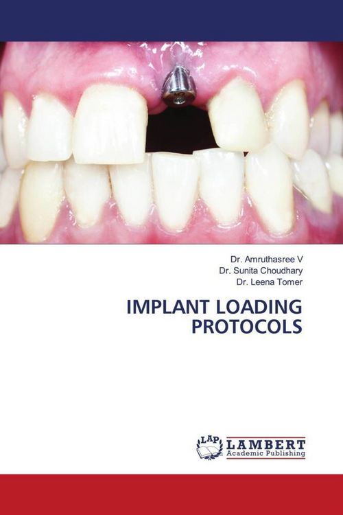 Produktbild: Implant Loading Protocols