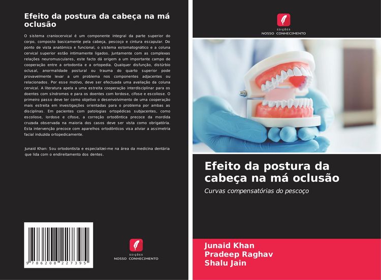 Produktbild: Efeito da postura da cabe&ccedil;a na m&aacute; oclus&atilde;o