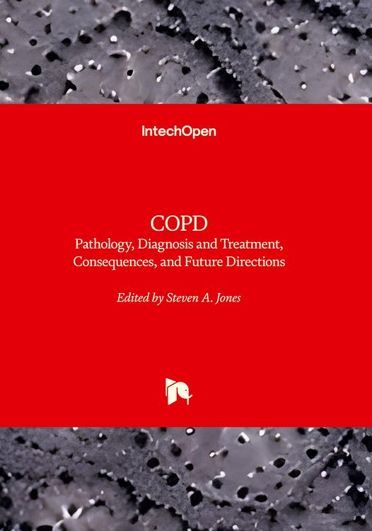 Produktbild: COPD - Pathology, Diagnosis, Treatment, and Future Directions