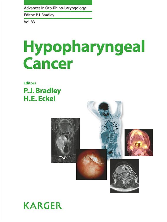 Produktbild: Hypopharyngeal Cancer