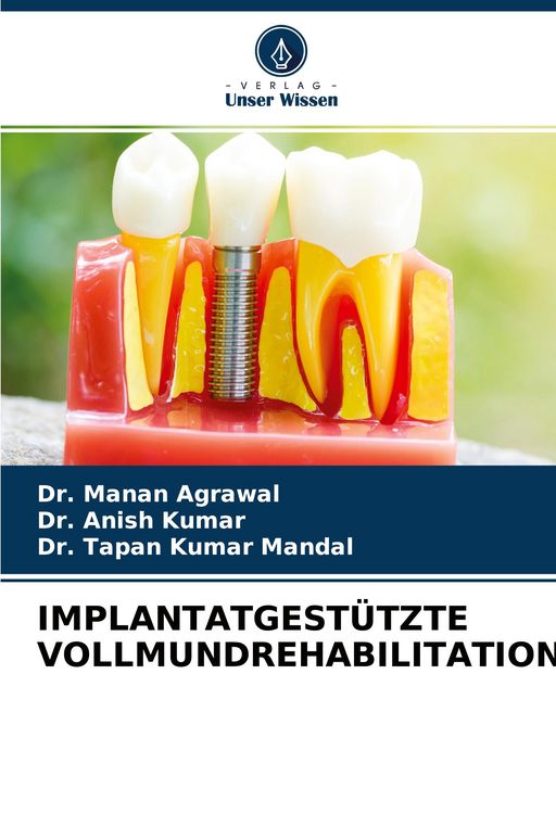 Produktbild: Implantatgest&uuml;tzte Vollmundrehabilitation