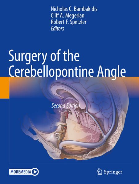 Produktbild: Surgery of the Cerebellopontine Angle