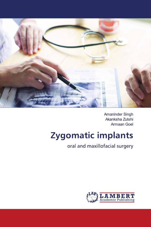 Produktbild: Zygomatic implants