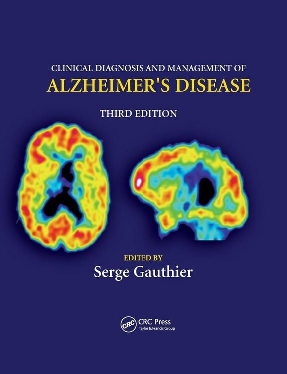 Produktbild: Clinical Diagnosis and Management of Alzheimer's Disease