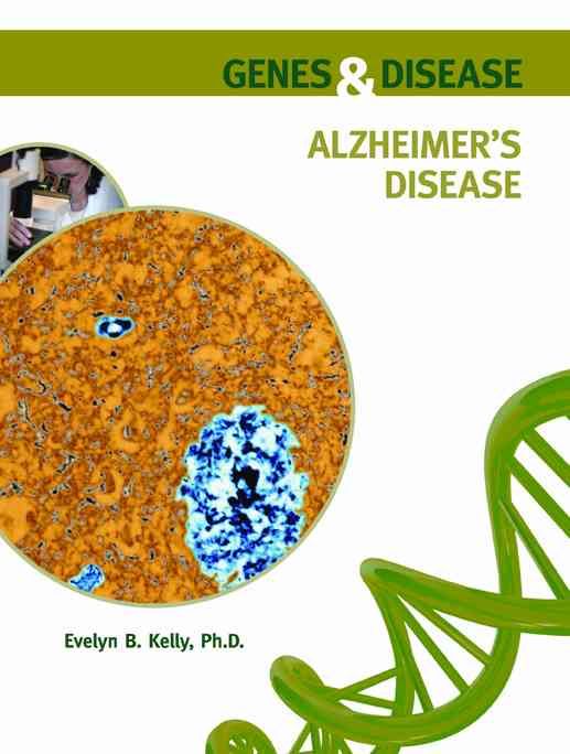 Produktbild: Kelly, E: Alzheimer's Disease