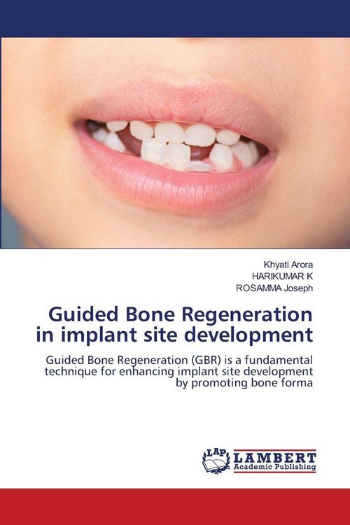 Produktbild: Guided Bone Regeneration in implant site development
