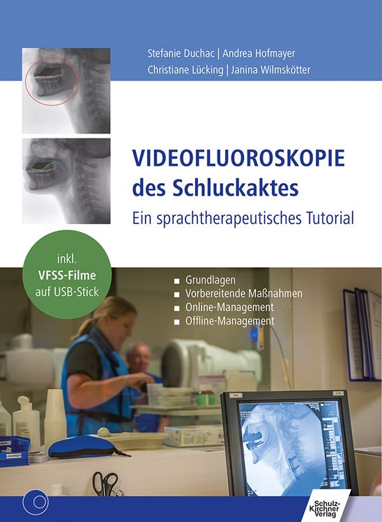 Produktbild: Videofluoroskopie des Schluckaktes