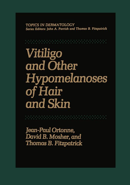 Produktbild: Vitiligo and Other Hypomelanoses of Hair and Skin