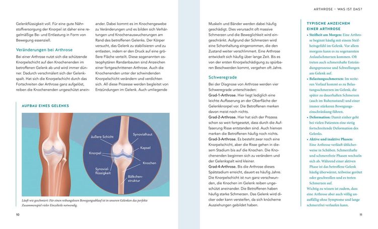 Produktbild: Schmerzfrei bei Arthrose