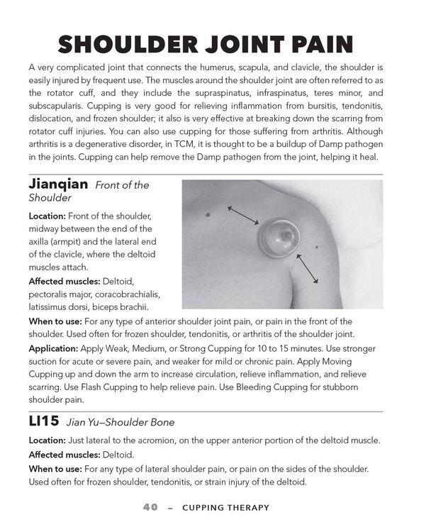 Produktbild: Cupping Therapy for Muscles and Joints