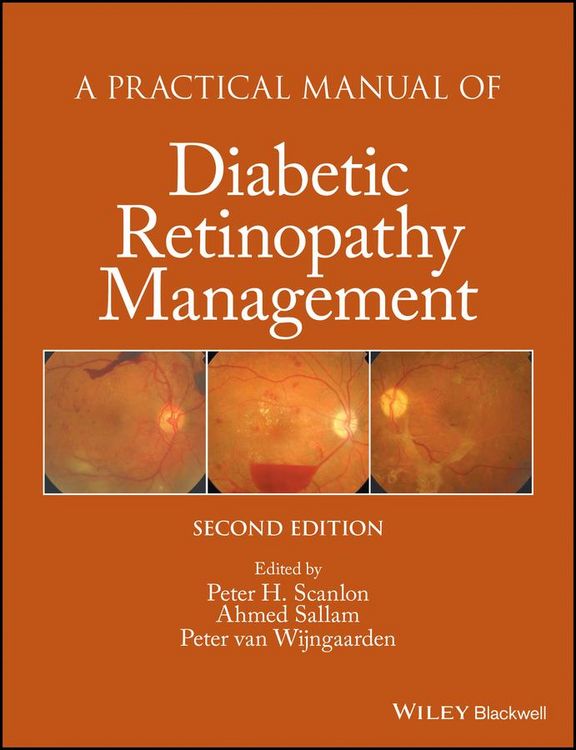 Produktbild: A Practical Manual of Diabetic Retinopathy Management