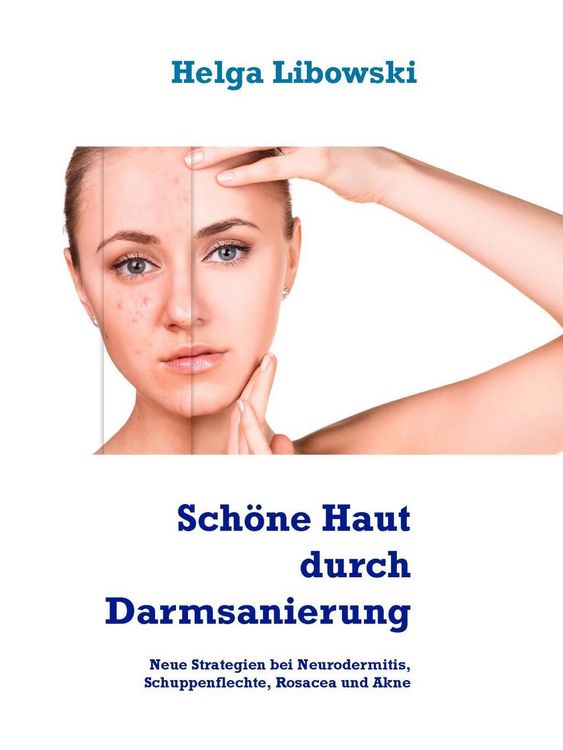 Produktbild: Sch&ouml;ne Haut durch Darmsanierung