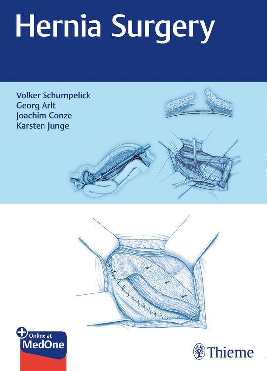 Produktbild: Hernia Surgery