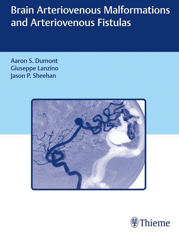 Produktbild: Brain Arteriovenous Malformations and Arteriovenous Fistulas