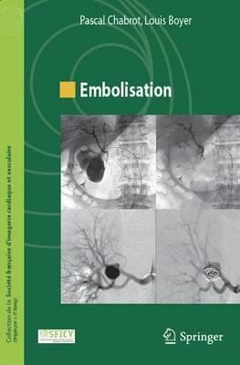 Produktbild: Embolisation