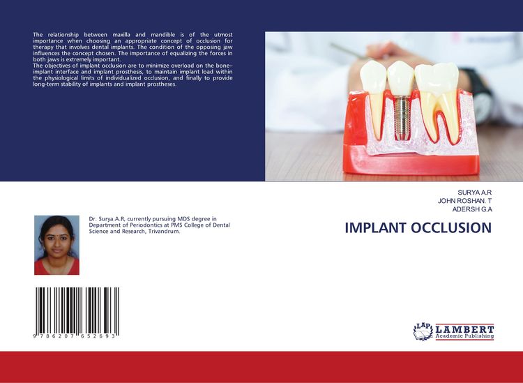 Produktbild: Implant Occlusion