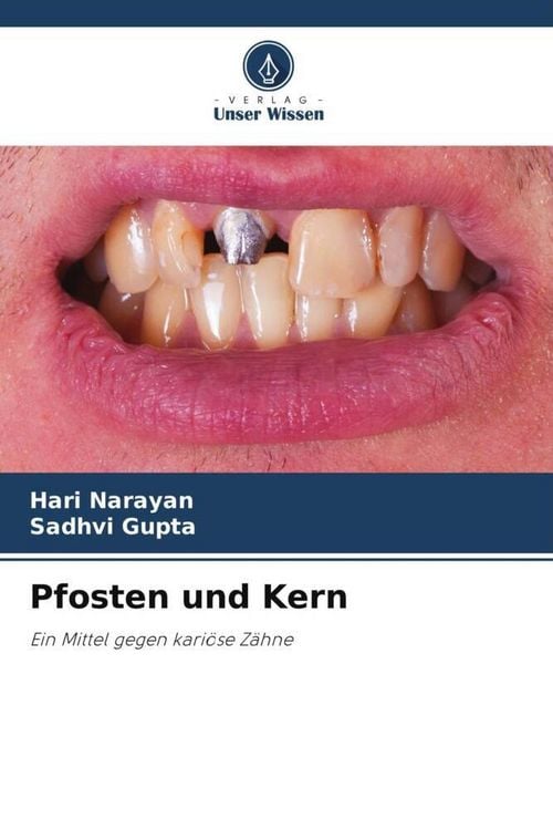 Produktbild: Pfosten und Kern