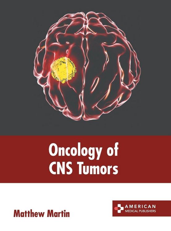 Produktbild: Oncology of CNS Tumors