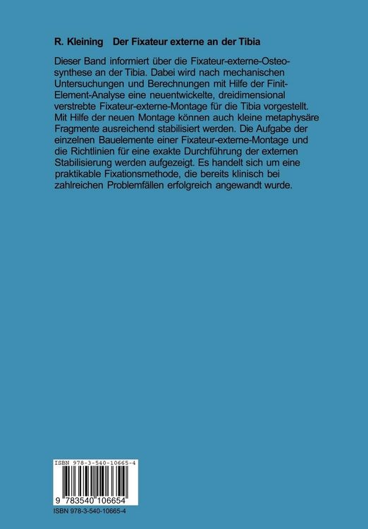 Produktbild: Der Fixateur externe an der Tibia