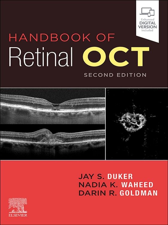 Produktbild: Handbook of Retinal OCT: Optical Coherence Tomography E-Book